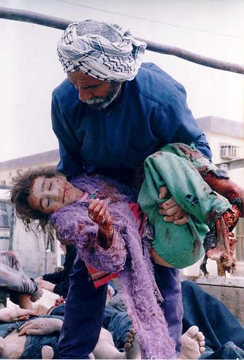 Bloodied Child of Iraq